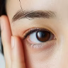 二重切開法のイメージ写真