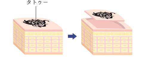 タトゥーの剥削術　イメージ