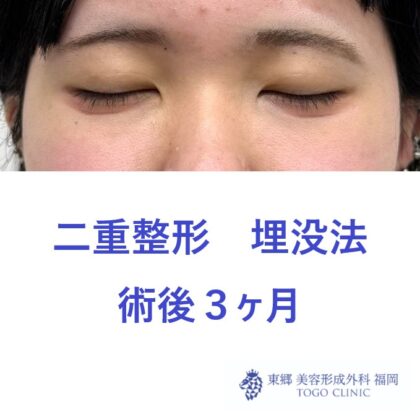 NY 術後３M - コピー