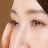 目の下のクマ：総論のイメージ写真
