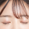 おでこ（額）のヒアルロン酸整形