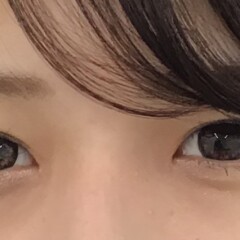 術後正面