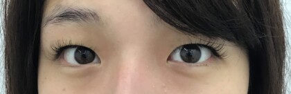 術前 正面