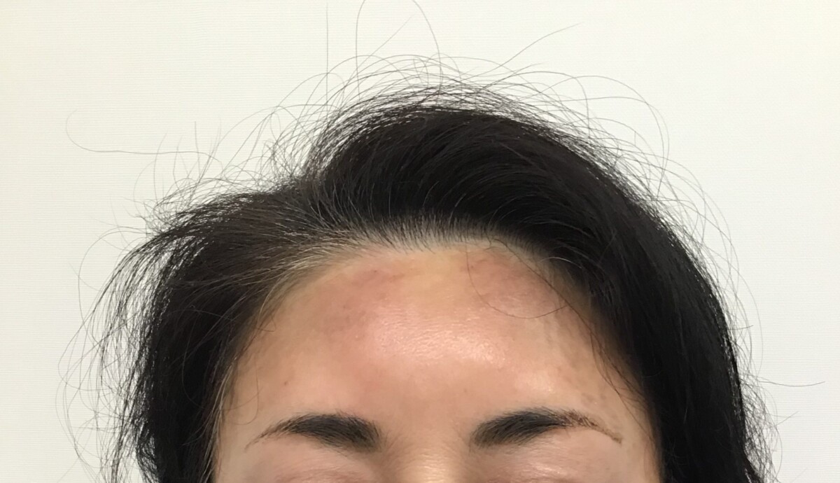 After