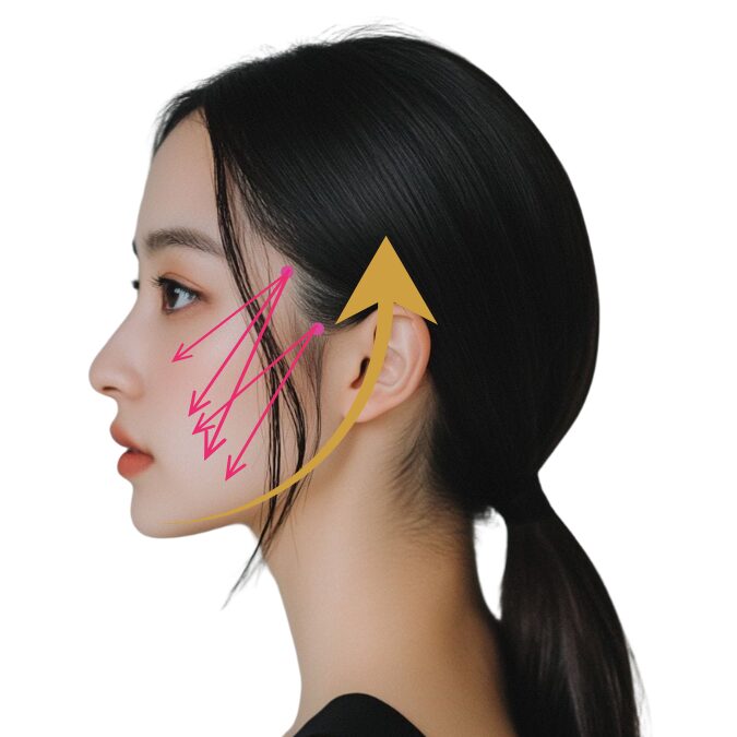 物理的なたるみの引き上げ