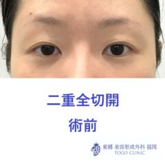 web_24880_R