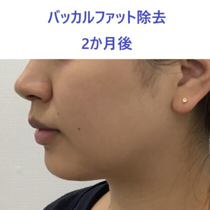 web_25726