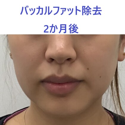 web_25729