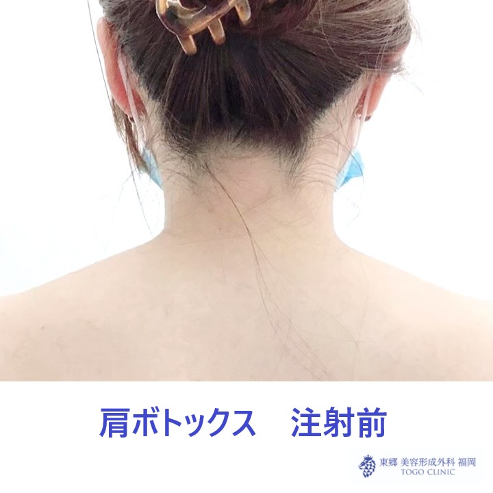 34 モリアヤメ　肩ボト　術前