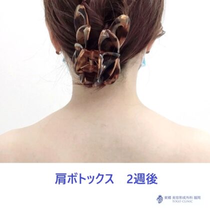 34 モリアヤメ　肩ボト　術後