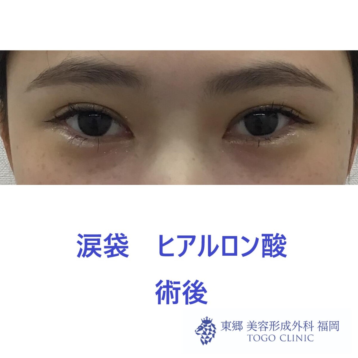 ﾊﾏﾁ　ﾌﾀﾊﾞ