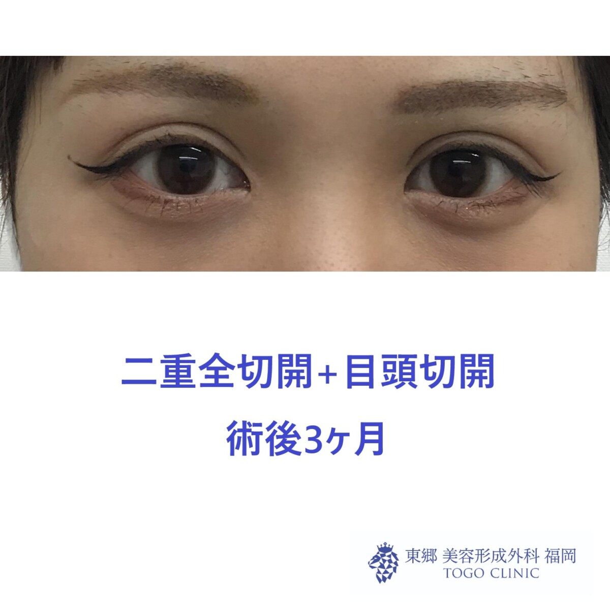 web_40665