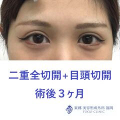web_40665_R