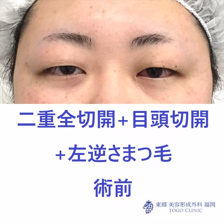 web_40510_R