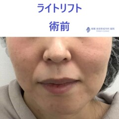 web_38187_R