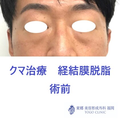 4225アライヨシハル正面