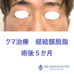 4225アライヨシハル術後正面
