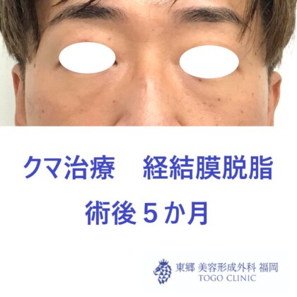 4225アライヨシハル術後正面