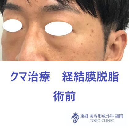 4225アライヨシハル術前