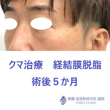 4225アライヨシハル術後