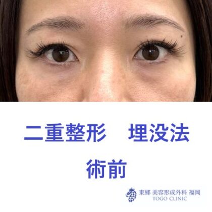 術前