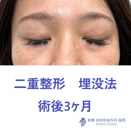 術後 (2)
