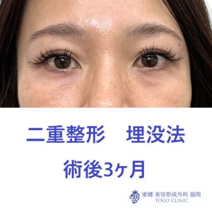 術後