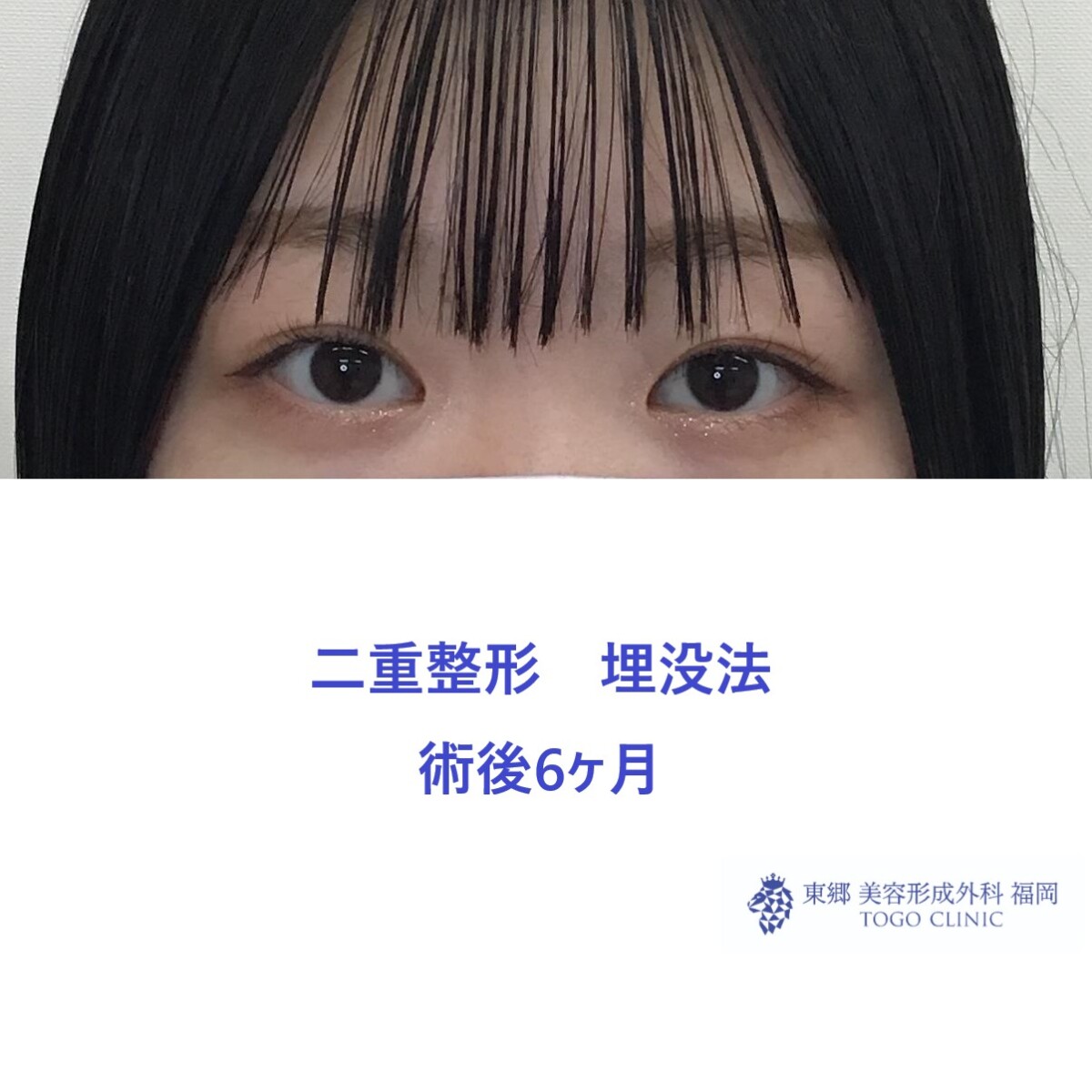6ヶ月後
