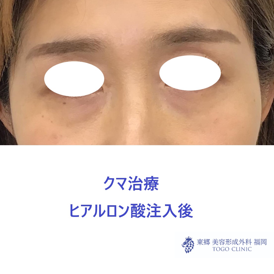 術後