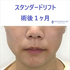 64823ba7affa6b0b1d9a20778d835f1f_R