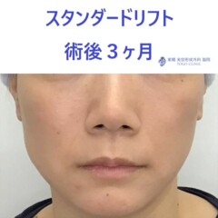 ﾅｶﾞﾀｱｷｺ　術後