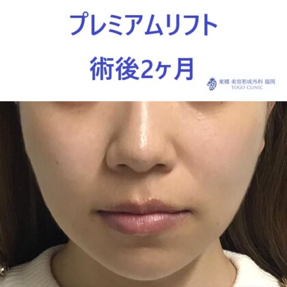 クドウヒトミ 術後