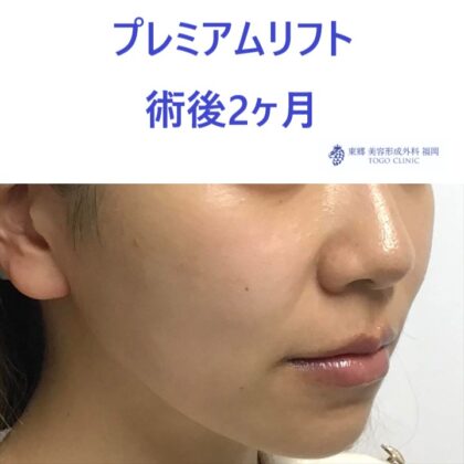 ｸﾄﾞｳﾋﾄﾐ　術後 (2)