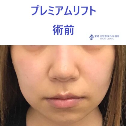 クドウヒトミ 術前