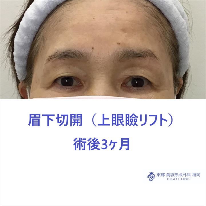 タイトルなし4_R