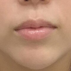 唇のしみについて💋✨