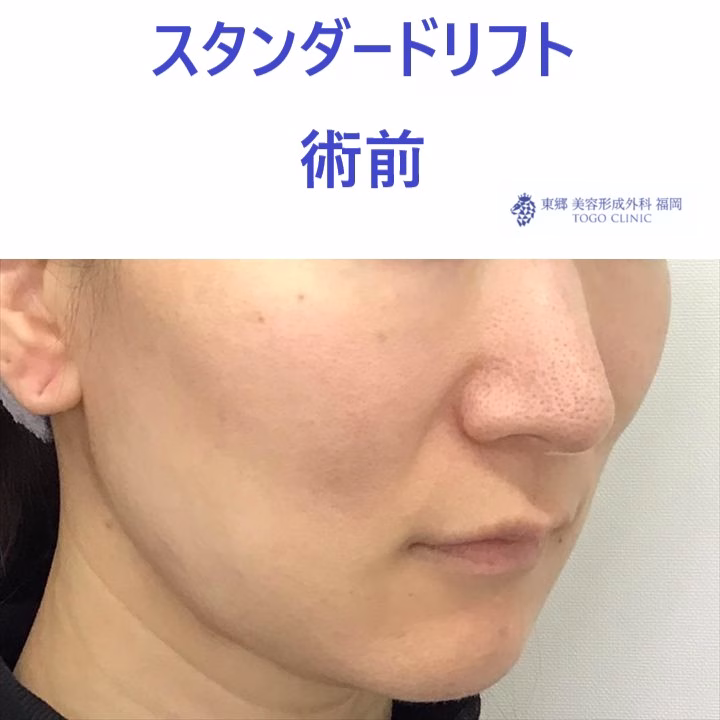 ﾔｼﾞﾏｴﾐ術前 (2)