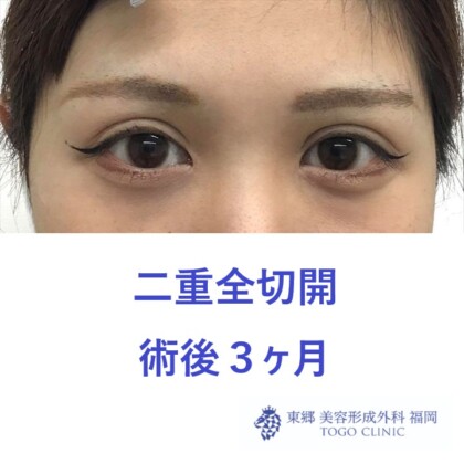 web_40665_R