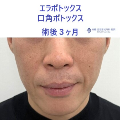 タハラノブヒロ術後