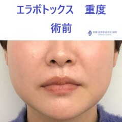 術前