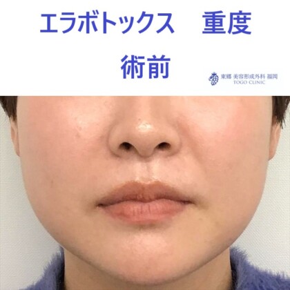 術前