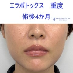 術後
