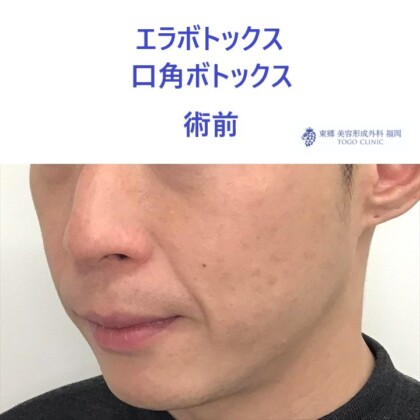 タハラノブヒロ術前 (2)