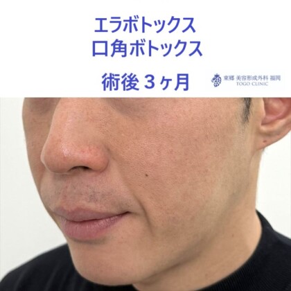 タハラノブヒロ術後 (2)