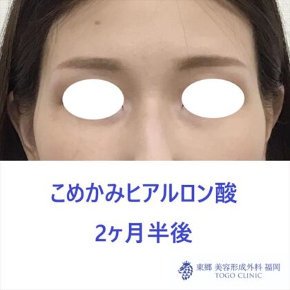 0b76a5c949cc625f9b094c396e443700