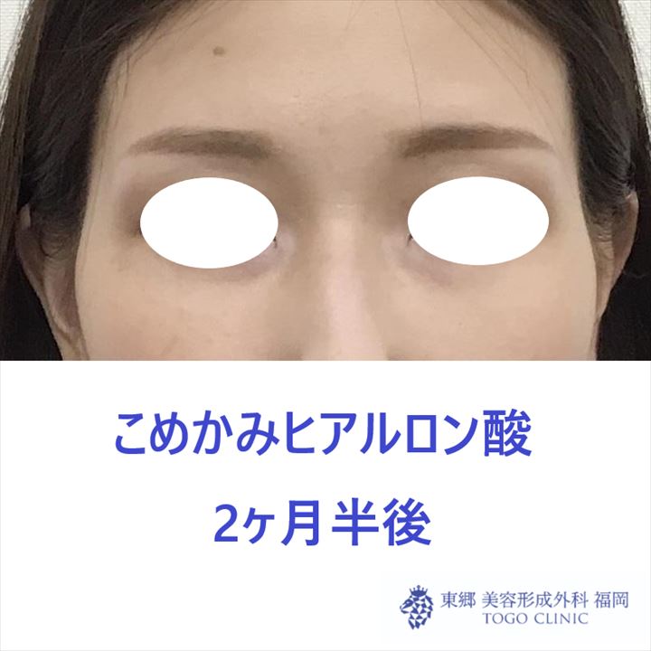 0b76a5c949cc625f9b094c396e443700