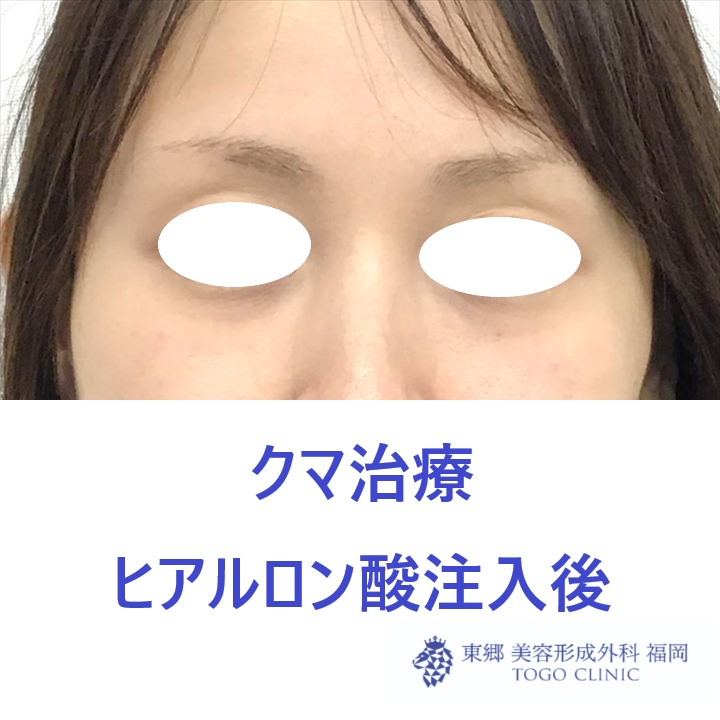 14b798318ff54458d99165f890e8b8a0.jpeg