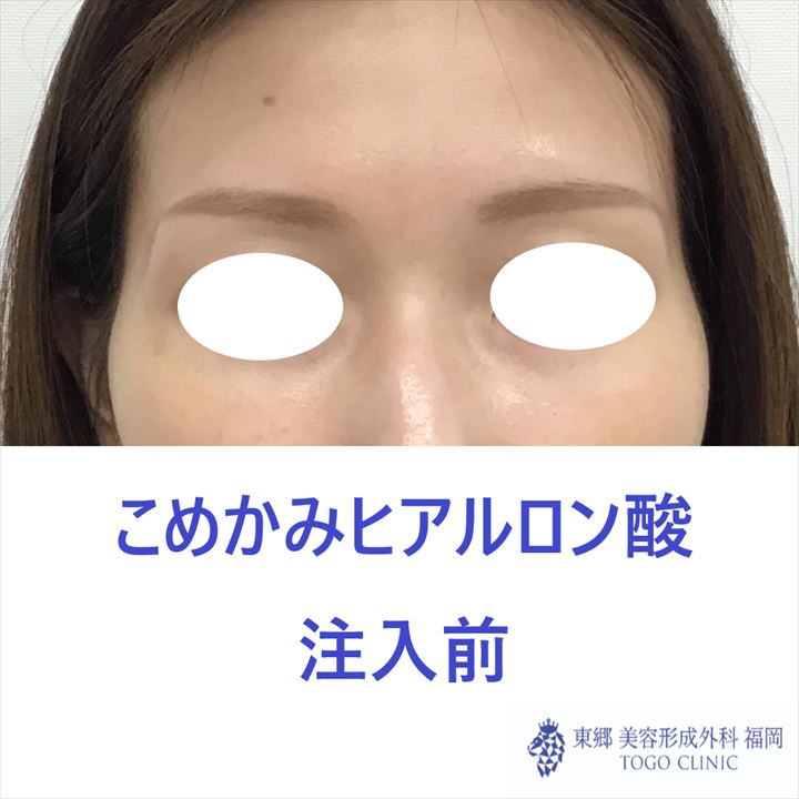 183785e59e0e446fc01cccf7473e4880