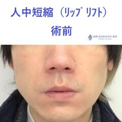 術前