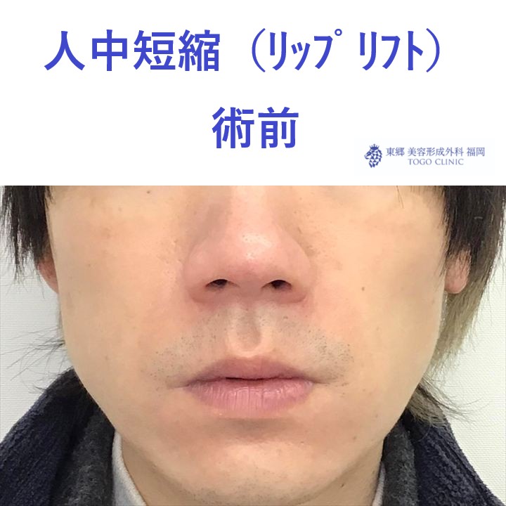 術前